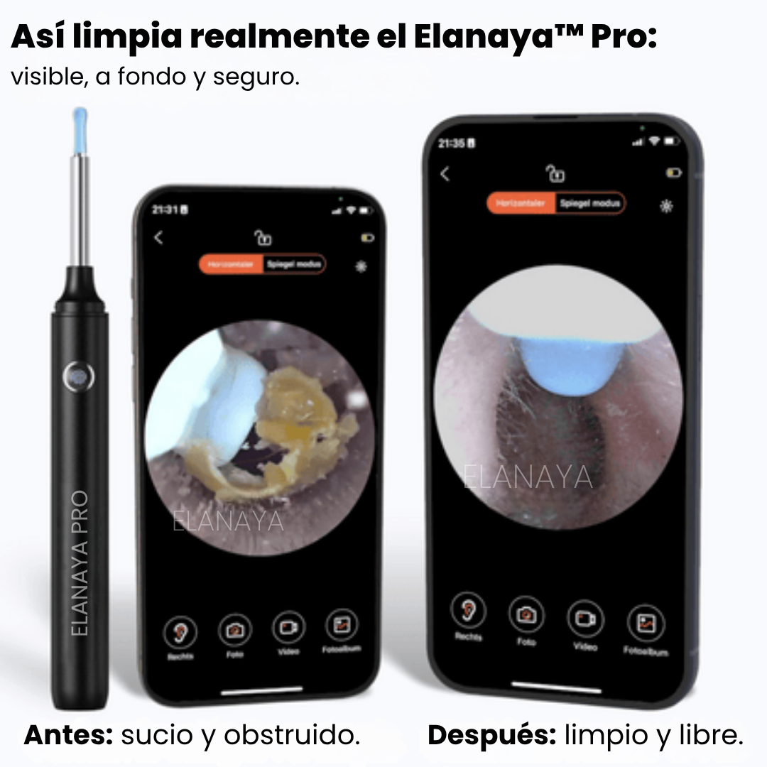 Elanaya™ Pro